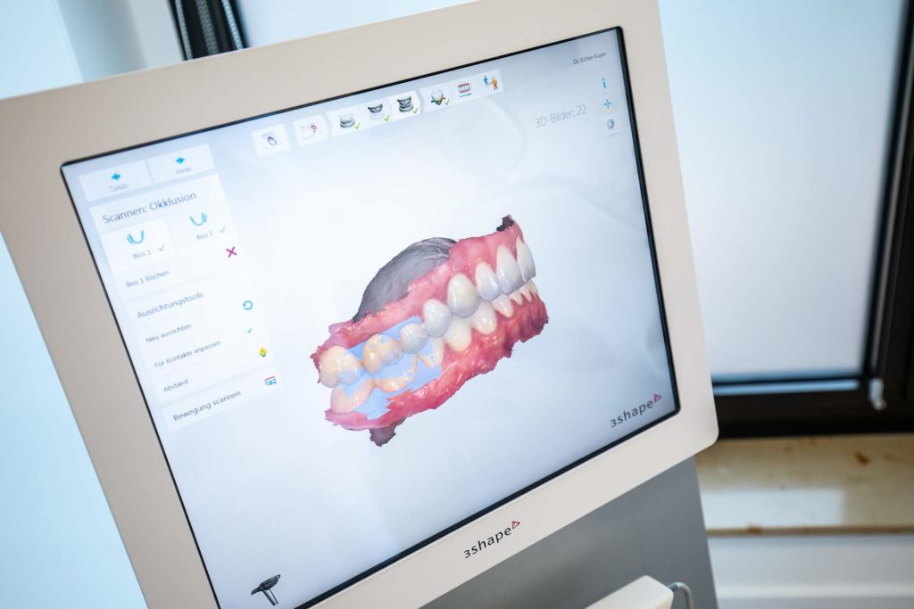 3d-scanner-Zahnspange