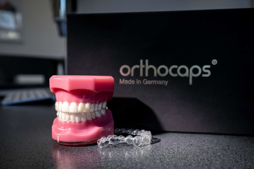 Aligner unsichtbare-Zahnspange (orthocaps®/ Invisalign®)